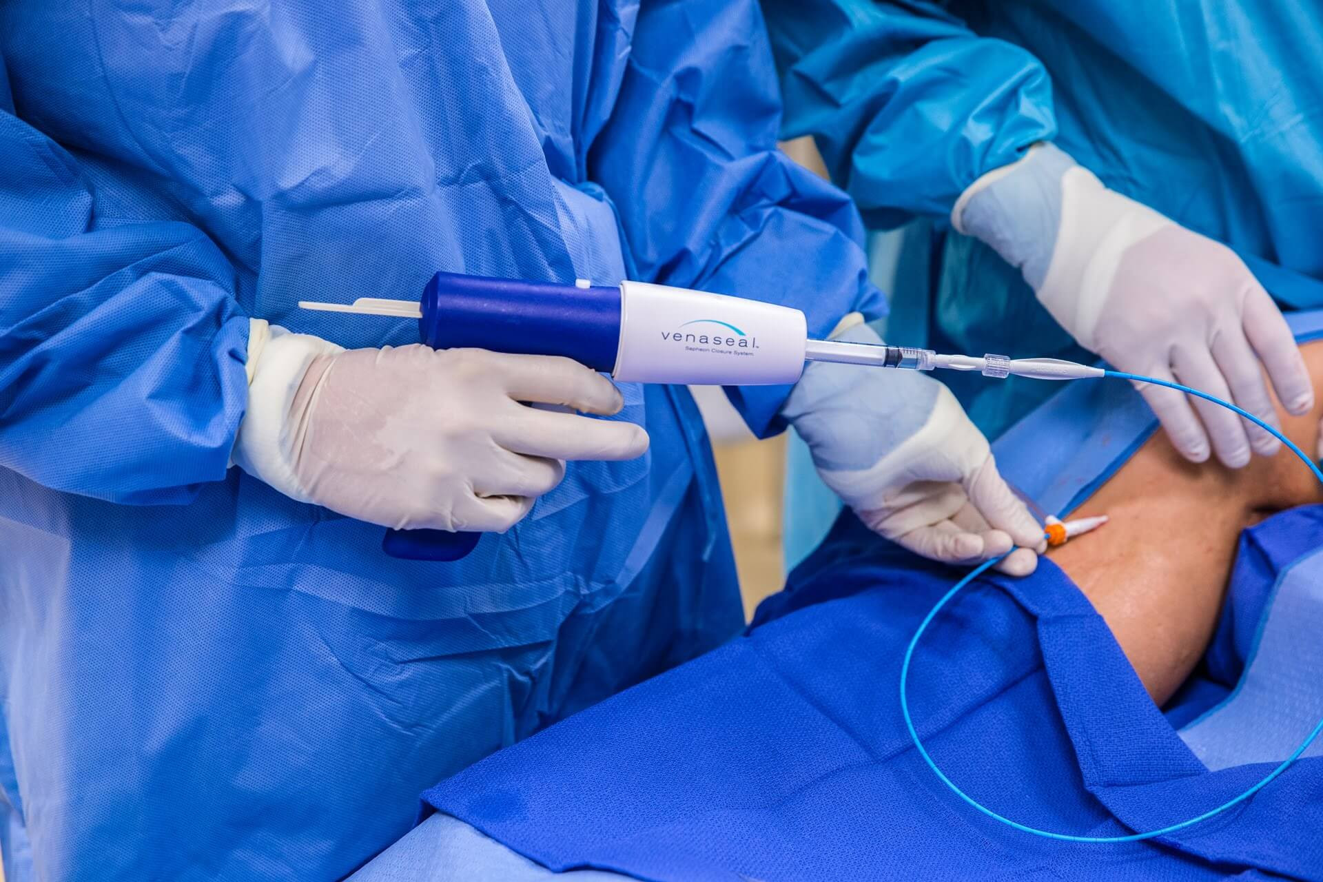 VenaSeal: Innovación en el Tratamiento de la Enfermedad Venosa